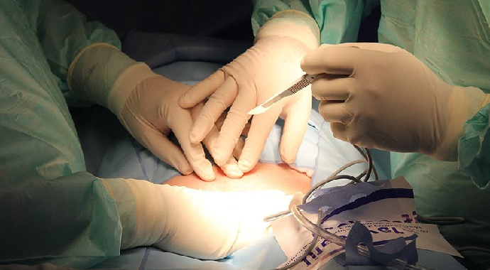 Organ ve Doku Nakli Sayıları Umut Veriyor