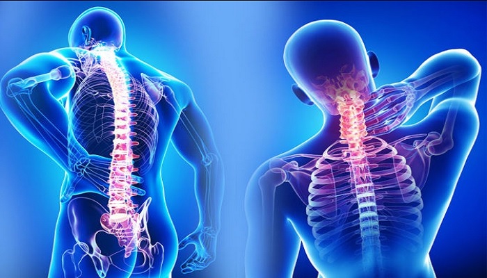 Fibromiyalji Nedir, Fibromiyalji Tedavisi ve Belirtileri Nelerdir?