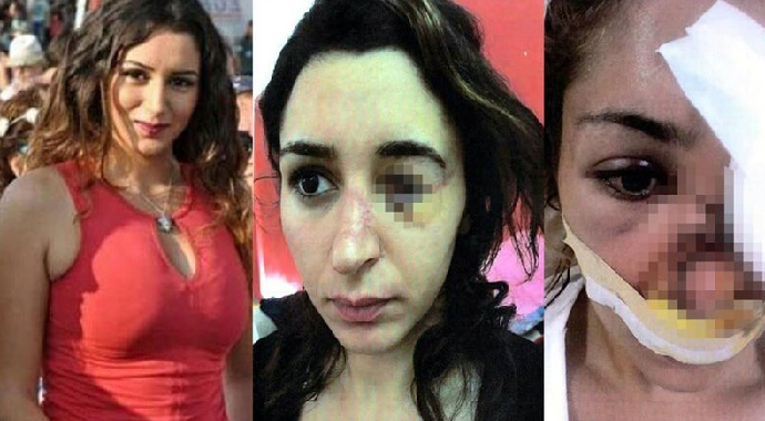 Tuğçe Aras’ı Vuran Zanlı Ağır Cezada Yargılanacak!