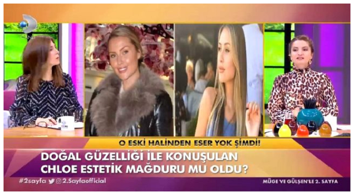 Chloe Loughnan Estetik Mağduru Oldu! Son Hali Şaşırttı