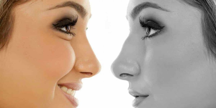 Ameliyatsız Burun Kaldırma Nedir? Nasıl Uygulanır? Ameliyatsız burun kalkar mı?