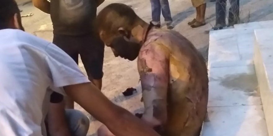 İzmir'de  dökülerek yakıldığı ileri sürülen kişi yaşam mücadelesini kaybetti