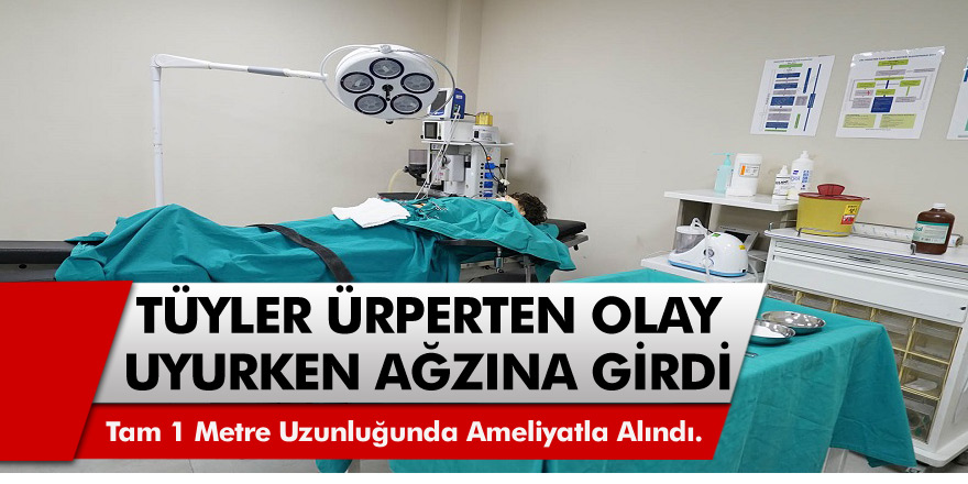 Tüyler ürperten olay! Uyurken ağzına girdi, operasyonla çıkarıldı