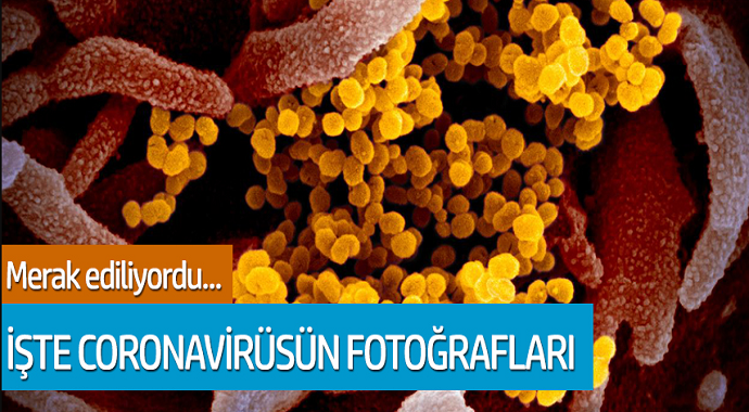 Merak konusu olan coronavirüsün fotoğrafları yayınlandı