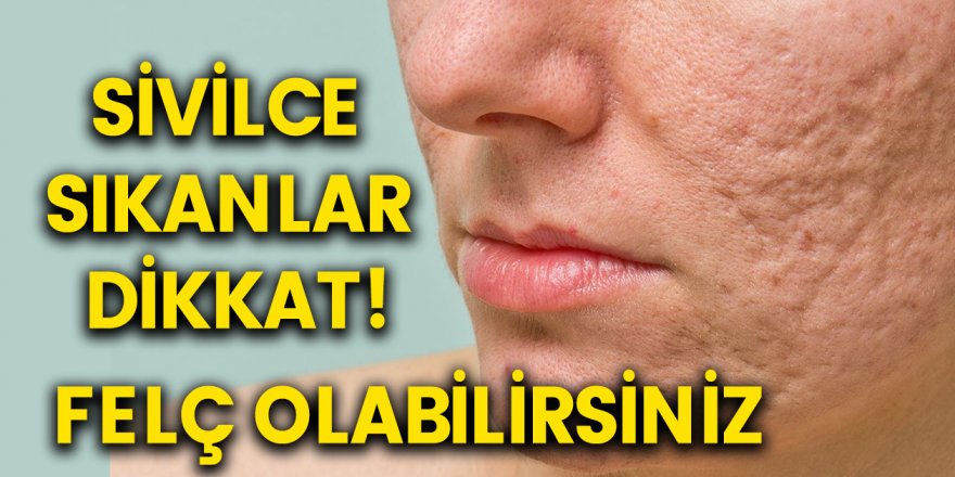 Dikkat! Sivilce Sıkmak Felce Neden Oluyor! Yapmaktan Vazgeçmelisiniz…