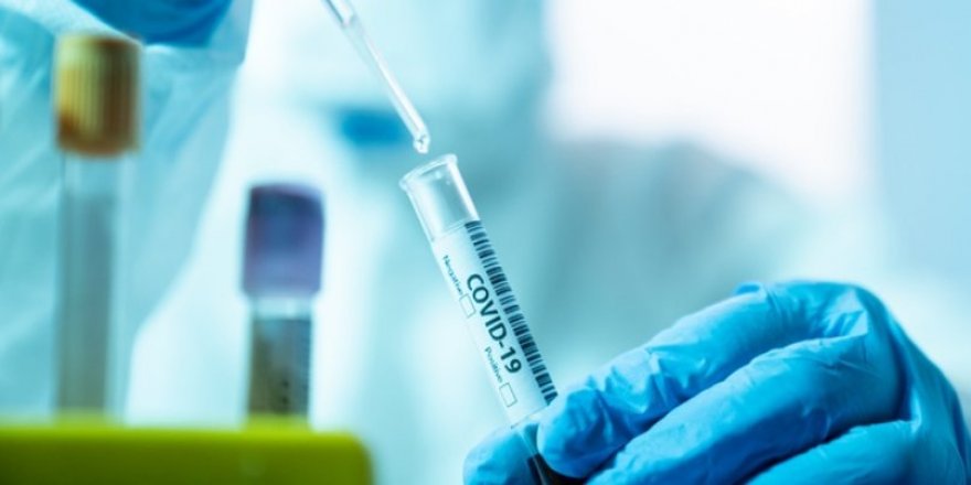 120 milyon hızlı Covid-19 testi, DSÖ düşük ve orta gelirli ülkelere gönderiliyor!