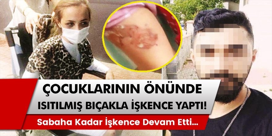 İstanbul’da bir kadın, çocukları önünde darp edildi! Isıtılmış bıçakla işkenceye uğradı….