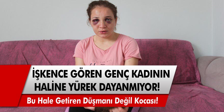 7 Senedir eşi tarafından işkence gören 3 çocuk annesinin haline yürek dayanmıyor!