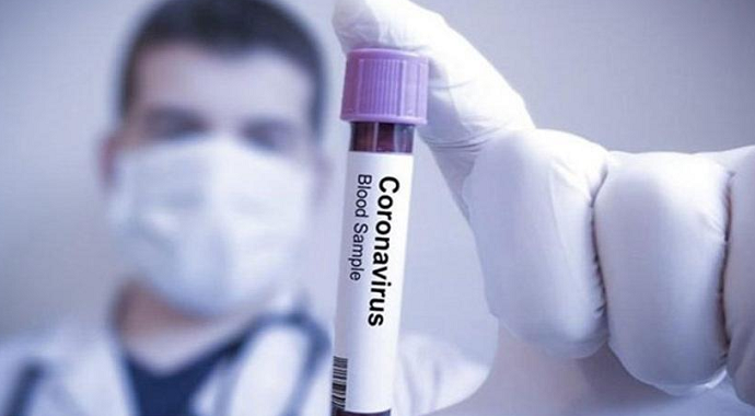 İsrail'de ilk korona virüsü vakası doğrulandı