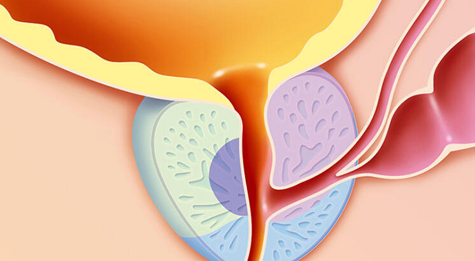 Prostat büyümesi nedir? Prostat büyüklüğü ne kadar olmalıdır?