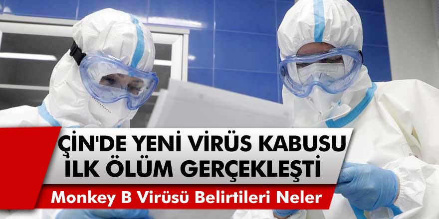 Çin'de ‘Monkey B’ Virüsü Kabusu! İlk Ölüm Gerçekleşti... Monkey B Virüsü Belirtileri Nelerdir?