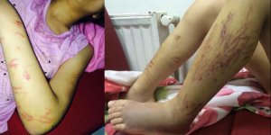 Çaresiz Anne Yardım Bekliyor