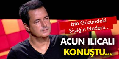 Acun Ilıcalı ilk kez 2. Sayfa programına konuştu! İşte gözündeki şişliğin sebebi...
