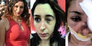 Tuğçe Aras’ı Vuran Zanlı Ağır Cezada Yargılanacak!