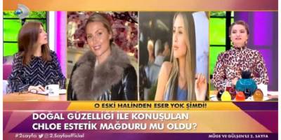 Chloe Loughnan Estetik Mağduru Oldu! Son Hali Şaşırttı