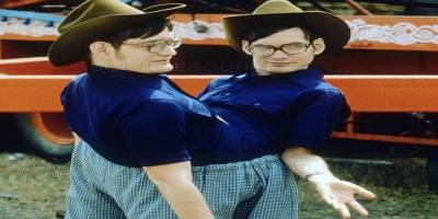 Dünyanın en uzun yaşayan yapışık ikizleri 68 yaşında öldü