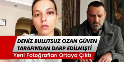 Ozan Güven tarafından darp edilen Deniz Bulutsuz’un yeni fotoğrafları ortaya çıktı