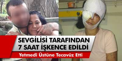 İstanbul'da Dilber Argın, sevgilisi tarafından 7 saat işkence edilip tecavüze uğradı!