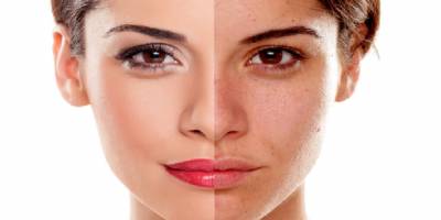 Yağlı Ciltler İçin Hangi Güneş Kremleri Tercih Edilmeli?