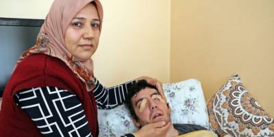 6 yıldır gözlerini kırpamıyor, kan çanağına dönen gözleri bantla kapatılıyor