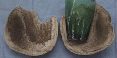 Karın ağrısı şikayetiyle hastaneye giden kadının cinsel organından kocaman bardak çıktı! Yıllardır utancından gidememiş!