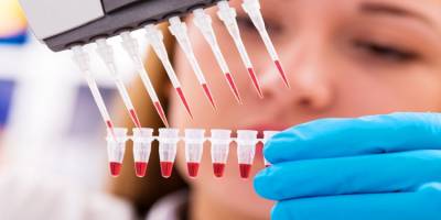 Gözaltı ışık dolgusu nedir? Nasıl uygulanır? Gözaltı ışık dolgusu ne işe yarar?