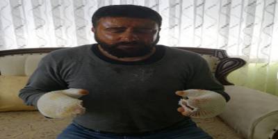 Bilecik'te elektrik çarpması sonucu ağır yaralanan vatandaş taburcu oldu